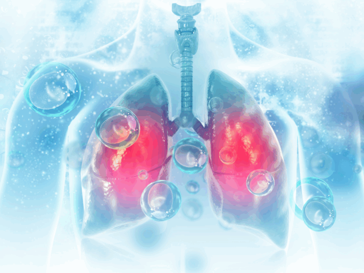 lung_cancer_diet